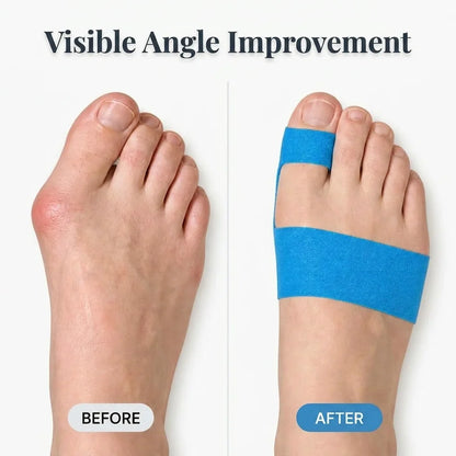 QuietStep™ – Elastische Hallux-valgus-Bandage für spürbare Schmerzlinderung