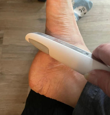 TurboSole Pro — Elektrischer Hornhautentferner für glatte Füße & einfache Fußpflege
