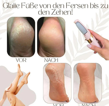 Pediluxe™ – Sanfte Füße in Minuten, ganz ohne Mühe!