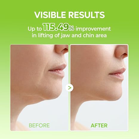 CactoLift™ – Kühlende Kollagen-V-Lifting-Maske für Kinn & Kiefer