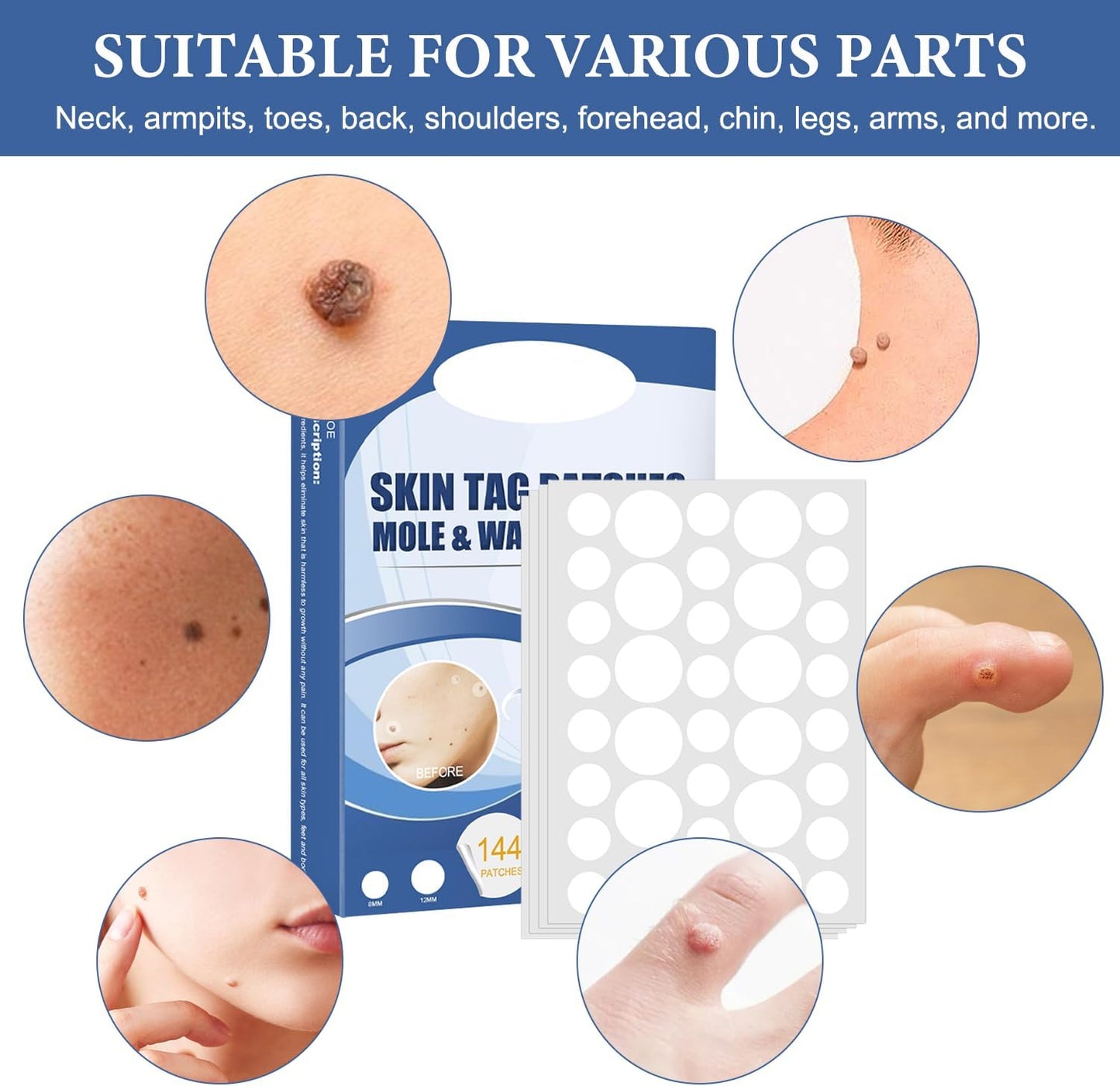 TagAway™ – Hautanhänger-Entfernungspflaster | Entfernt Skin Tags schmerzfrei in 7 Tagen