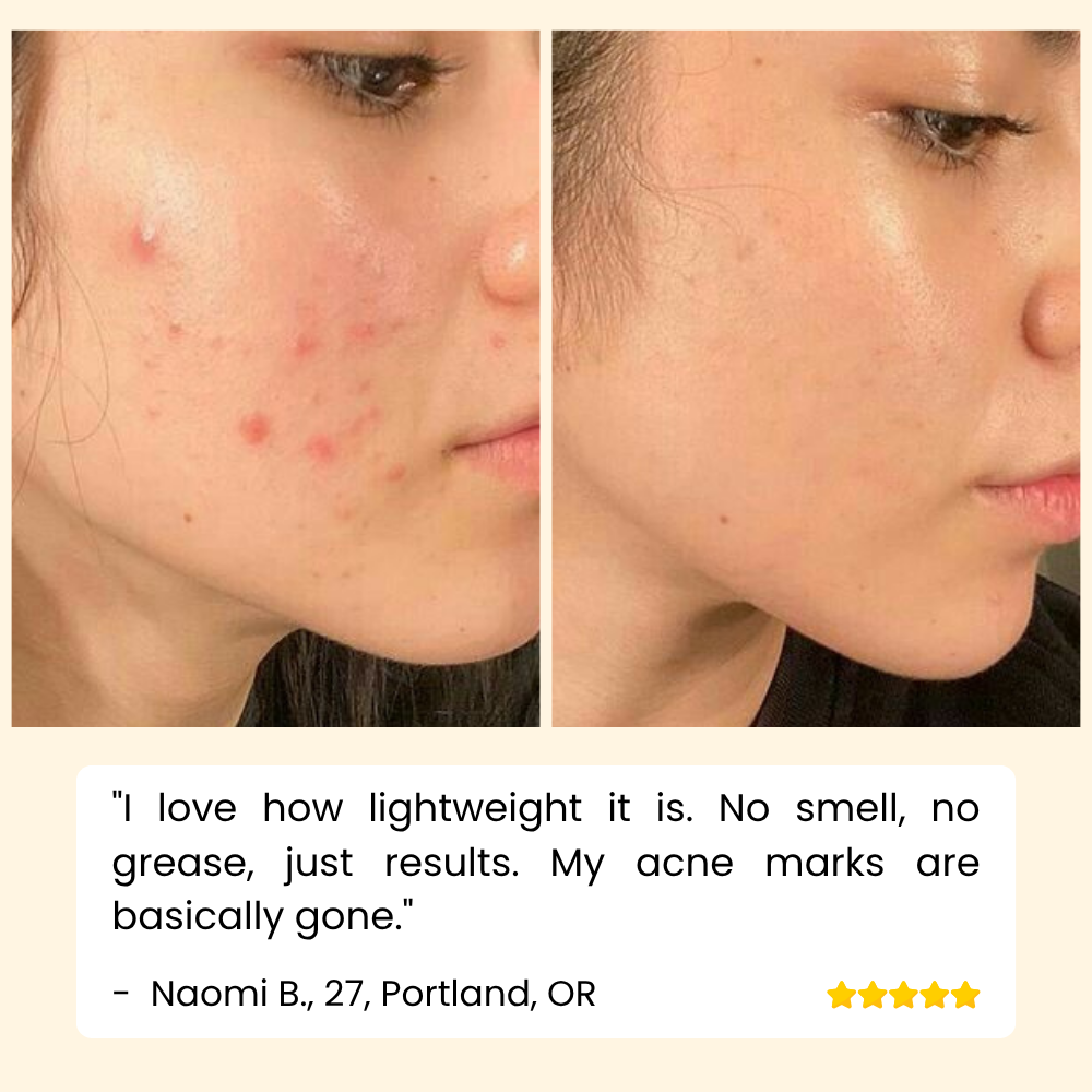 HOYGI – Eternity Vitamin‑C‑Serum für Gesicht, Hände & Körper
