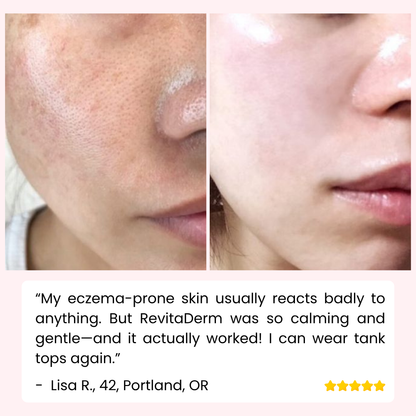 RevitaDerm — Sanftes Peeling-Gel für die tägliche Hautpflege