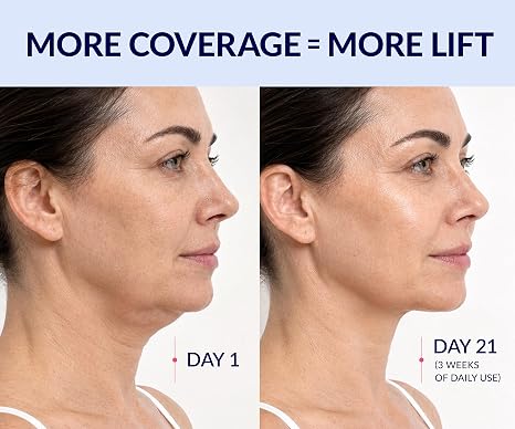 CactoLift™ – Kühlende Kollagen-V-Lifting-Maske für Kinn & Kiefer