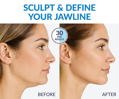 CactoLift™ – Kühlende Kollagen-V-Lifting-Maske für Kinn & Kiefer