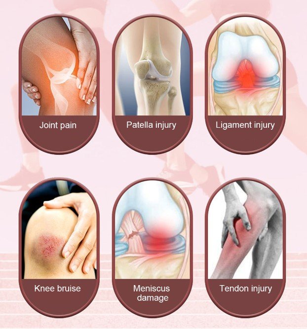 Sportliche Kniebandage – Kompressionsstütze als Sleeve