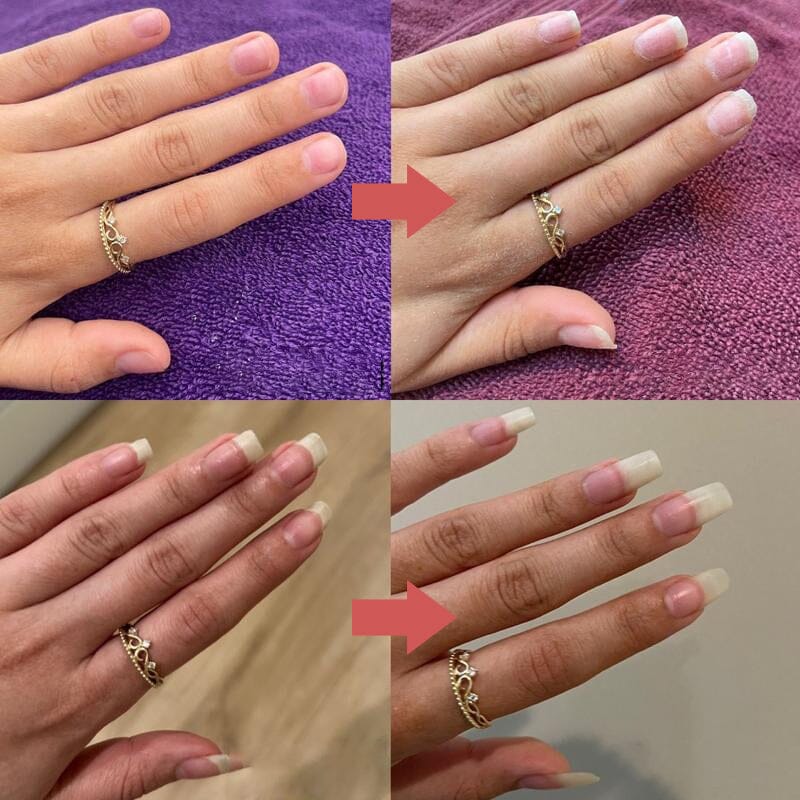 Seranail – Nagel- und Nagelhautpflegeöl