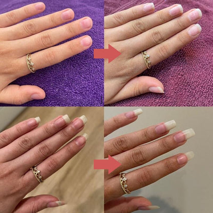 Seranail – Nagel- und Nagelhautpflegeöl