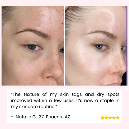 RevitaDerm — Sanftes Peeling-Gel für die tägliche Hautpflege