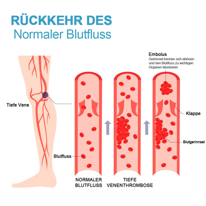 1+1 Gratis | FormSocken™ - Schlanke Beine und straffe Haut in einem Schritt!