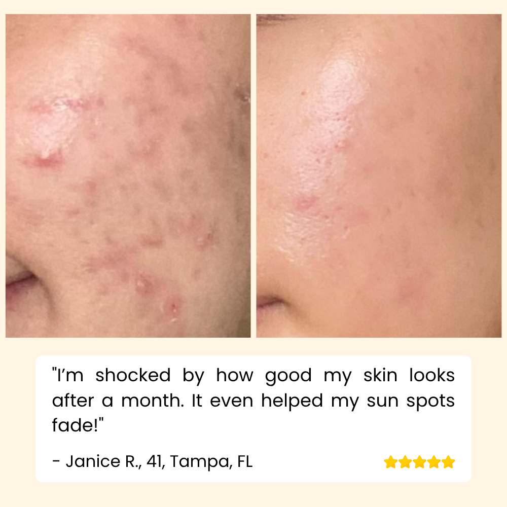 HOYGI – Eternity Vitamin‑C‑Serum für Gesicht, Hände & Körper