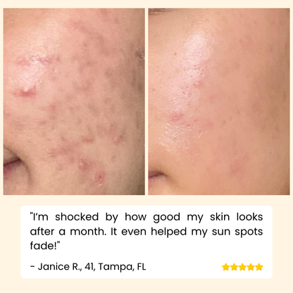 HOYGI – Eternity Vitamin‑C‑Serum für Gesicht, Hände & Körper