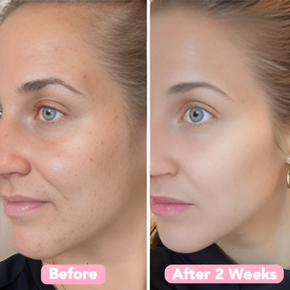 LumaSkin Radiance Pads — Peeling-Gesichtspads