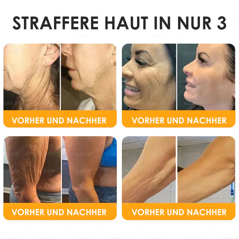 HealSkin™ – Straffende Anti-Aging-Creme mit Bienengift-Peptiden [1 + 1 Gratis]