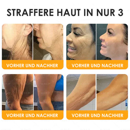 HealSkin™ – Straffende Anti-Aging-Creme mit Bienengift-Peptiden [1 + 1 Gratis]