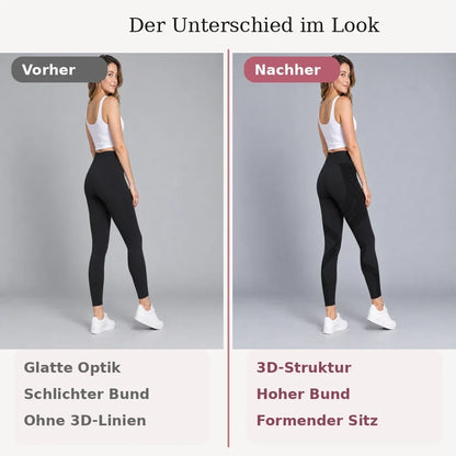Letzter Tag Rabatt! | SleekLegs™ Anti-Cellulite-Leggings – Für ein glatter wirkendes Hautbild und Beine zum Wohlfühlen