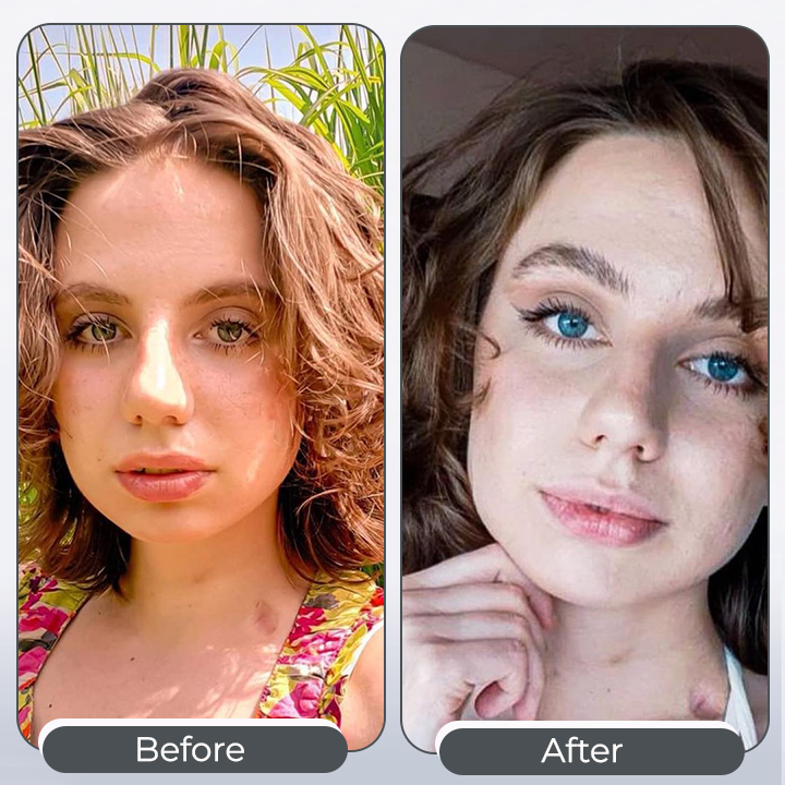 EyeKolor – Augentropfen zur Iris-Intensivierung – Strahlender Augen-Look