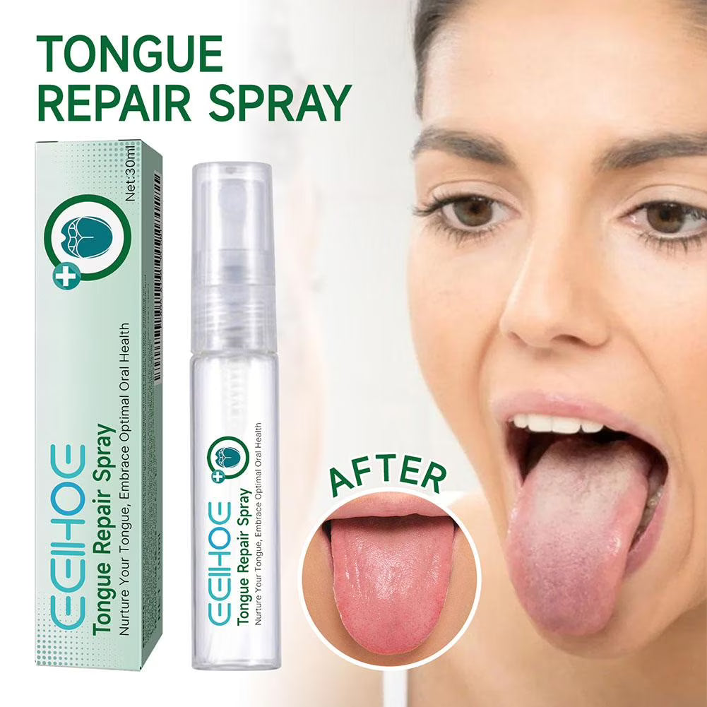 Tongue Repair Spray 30 ml – zur Reparatur, gegen Schwellung & Mundgeruch