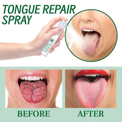 Tongue Repair Spray 30 ml – zur Reparatur, gegen Schwellung & Mundgeruch