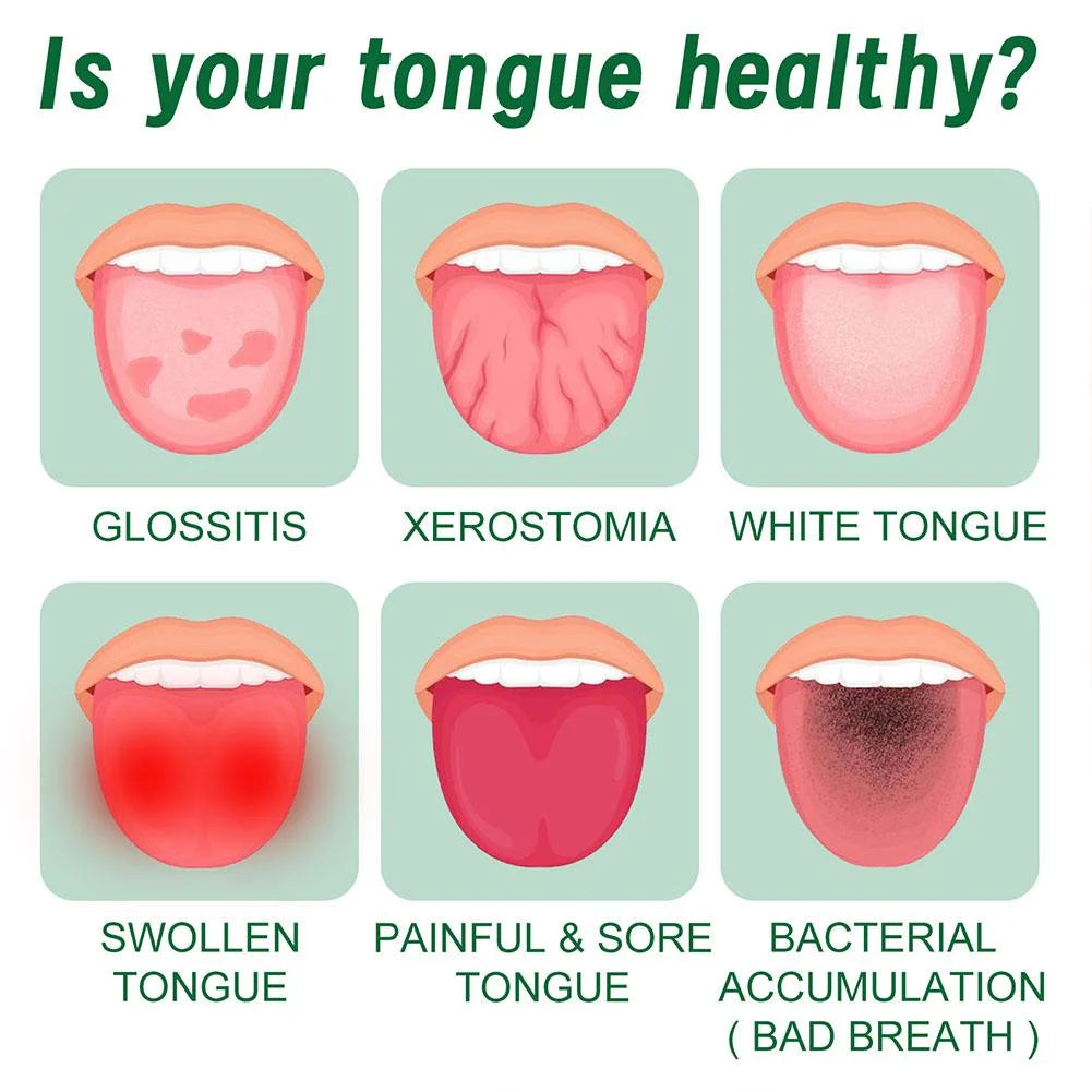 Tongue Repair Spray 30 ml – zur Reparatur, gegen Schwellung & Mundgeruch