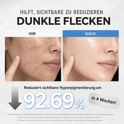 Madagascar Centella Tone Brightening Capsule Ampoule 100 ml – Hyaluron Serum für Feuchtigkeit, Glow & dunkle Flecken