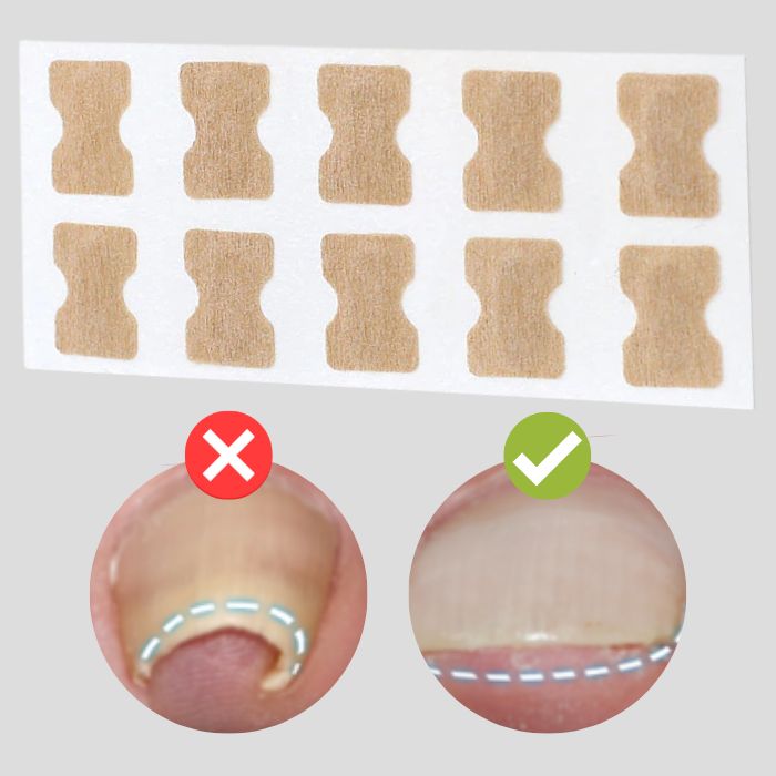 FinePatches – Nagelpflegepflaster