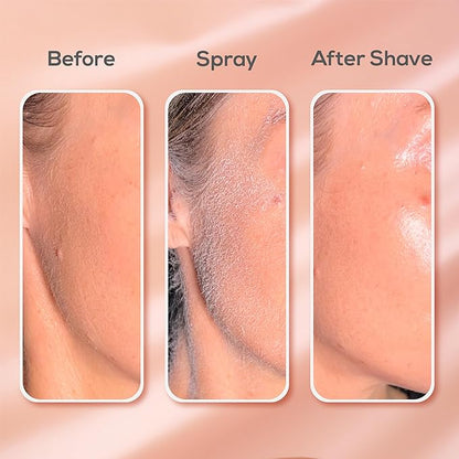 1+1 Gratis | SprayNova™ Spray zur Haarentfernung im Gesicht