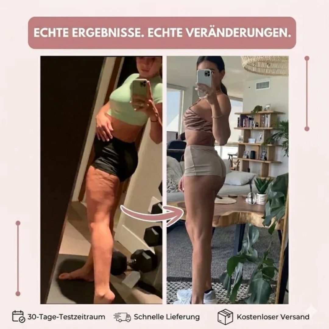 Letzter Tag Rabatt! | SleekLegs™ Anti-Cellulite-Leggings – Für ein glatter wirkendes Hautbild und Beine zum Wohlfühlen