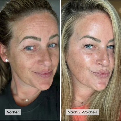 CollaFirm™ Kollagen-Maske für sichtbar glattere, festere Haut