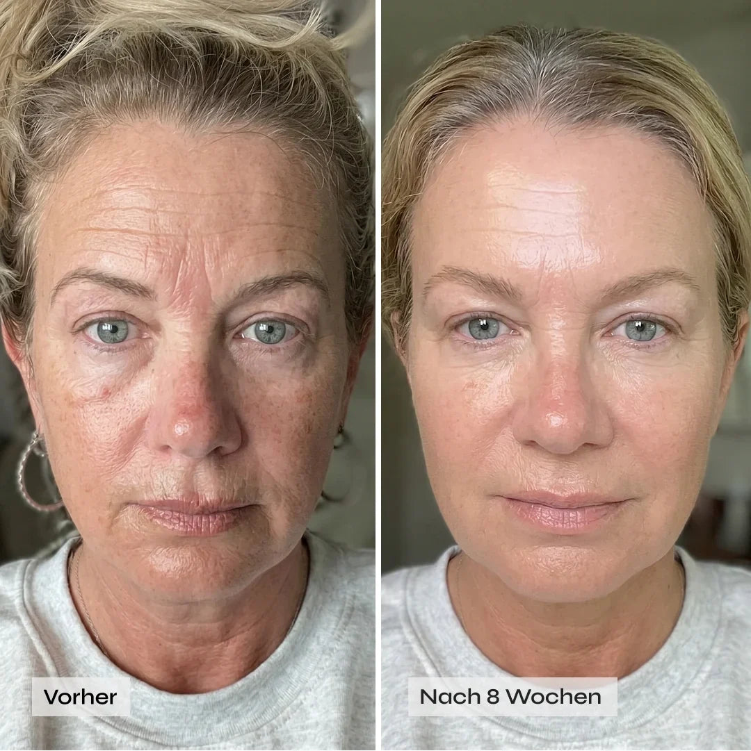 CollaFirm™ Kollagen-Maske für sichtbar glattere, festere Haut