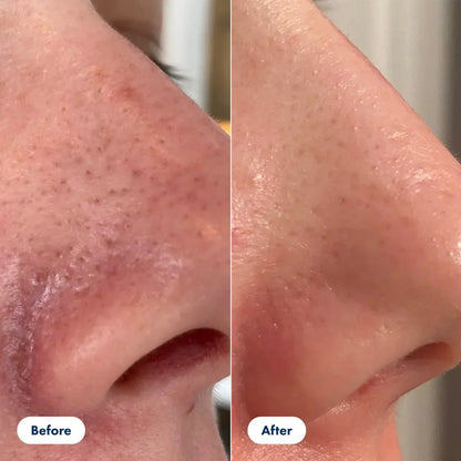 GlassSkin Pro – Feuchtigkeitsspendendes Hautpflege-Serum für glatte Haut