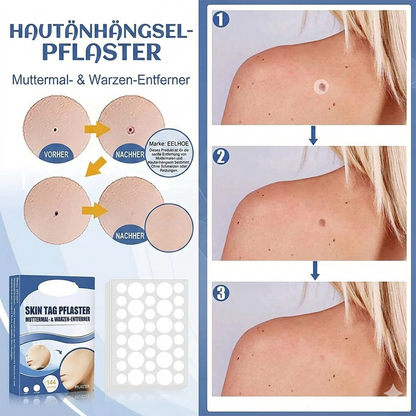 TagAway™ – Premium Hautanhänger-Entfernungspflaster | Entfernt Skin Tags schmerzfrei in 7 Tagen