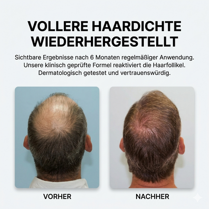 Xtrallux TurboPro (316) Professionelle Laserhaube für dichteres Haar