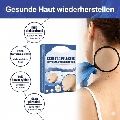 TagAway™ – Premium Hautanhänger-Entfernungspflaster | Entfernt Skin Tags schmerzfrei in 7 Tagen