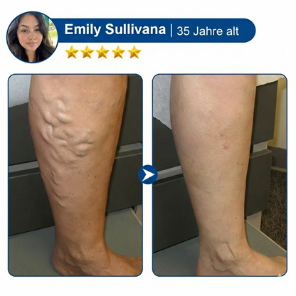 VeinTarget Mikronadelpflaster + 10-IN-1 𝗙ortschrittliches 𝗡ano-Mikronadel-𝑷𝒇𝒍𝒂𝒔𝒕𝒆𝒓 -Für weniger Schmerzen und Schwellungen, reduzierte Äderchen und stärkt die Gefäße