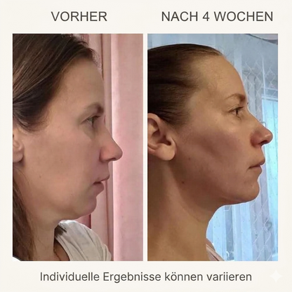 MAMI L&L SKIN Hot & Cold – Deine professionelle Hautpflege für Zuhause [Letzter Tag Rabatt]