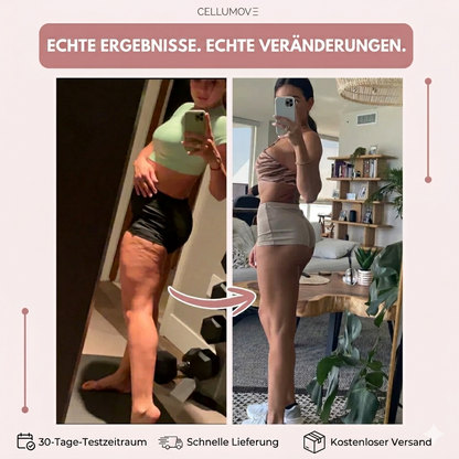 Die Anti-Cellulite-Leggings – für sichtbar glattere Beine in nur 14 Tagen