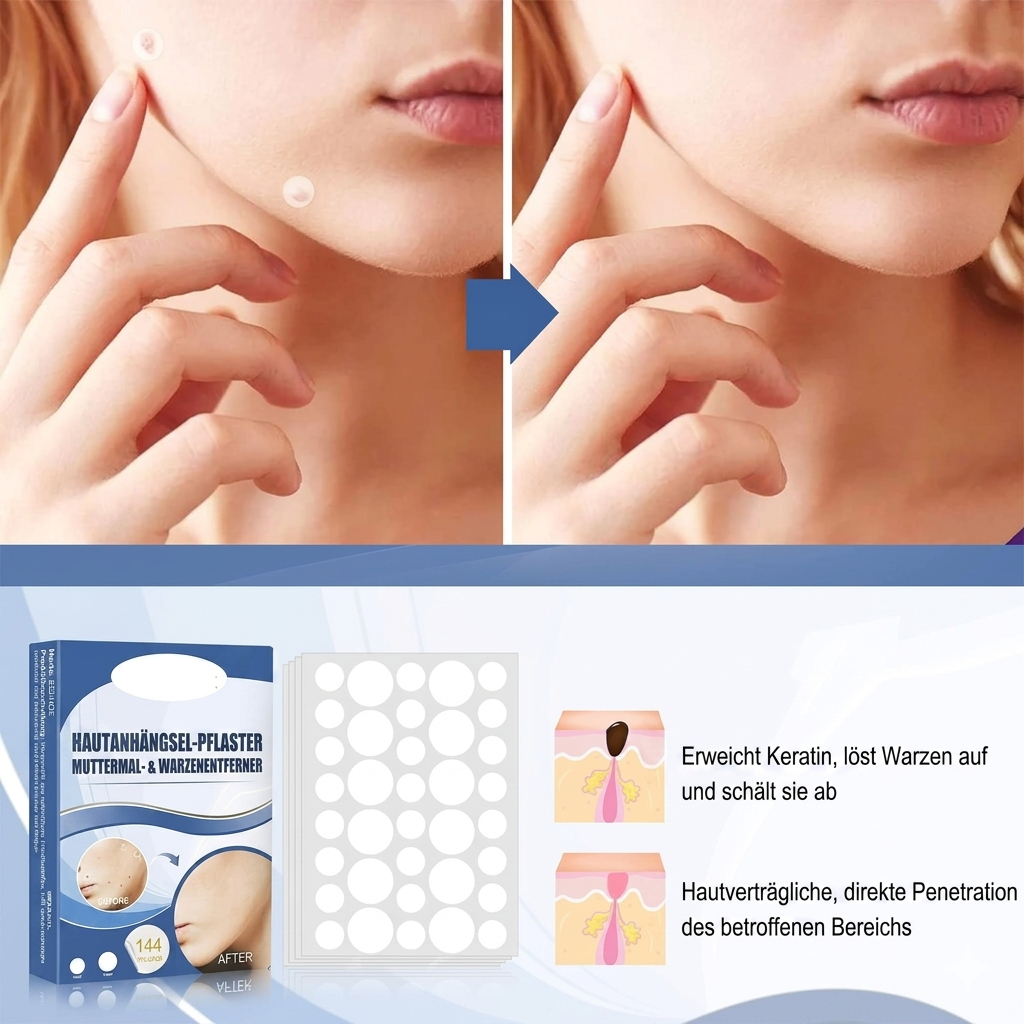 TagAway™ – Premium Hautanhänger-Entfernungspflaster | Entfernt Skin Tags schmerzfrei in 7 Tagen