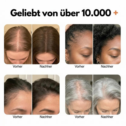 Nur heute: 1+1 gratis! | Aume™ Koreas Haarwuchsserum Nr. 1