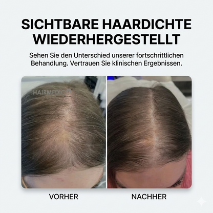 Xtrallux TurboPro (316) Professionelle Laserhaube für dichteres Haar
