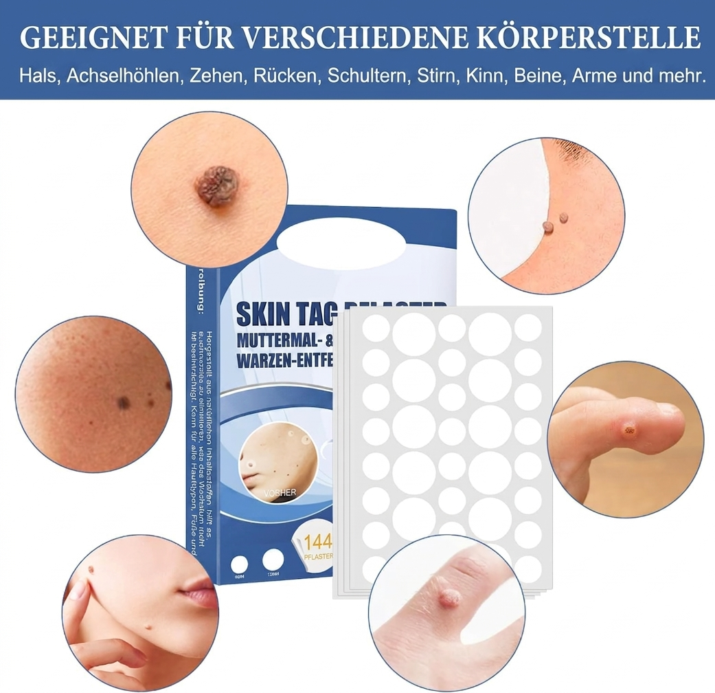 TagAway™ – Premium Hautanhänger-Entfernungspflaster | Entfernt Skin Tags schmerzfrei in 7 Tagen