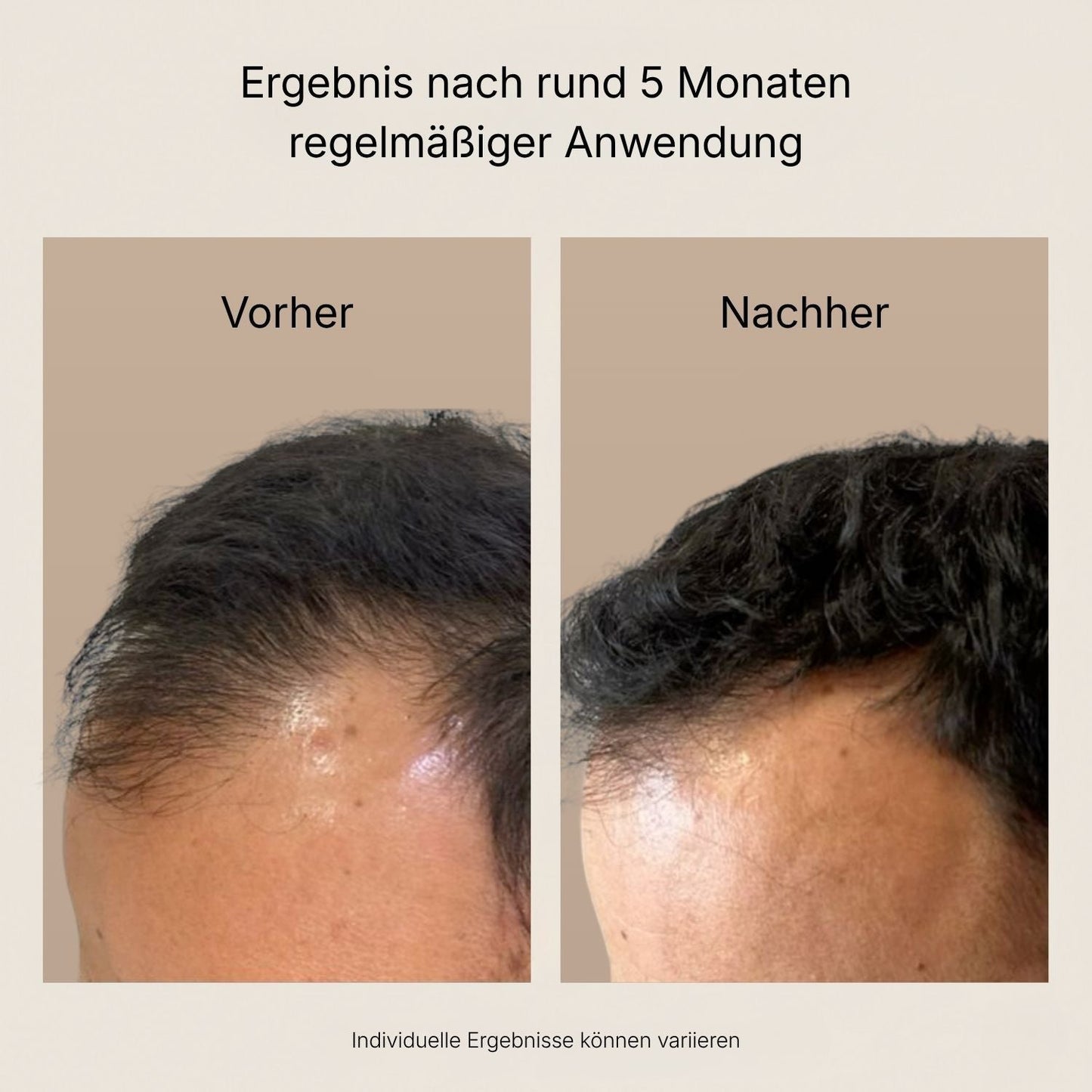 HairVella™ – Aufbauende Haarkur für geschmeidiges, glänzendes Haar