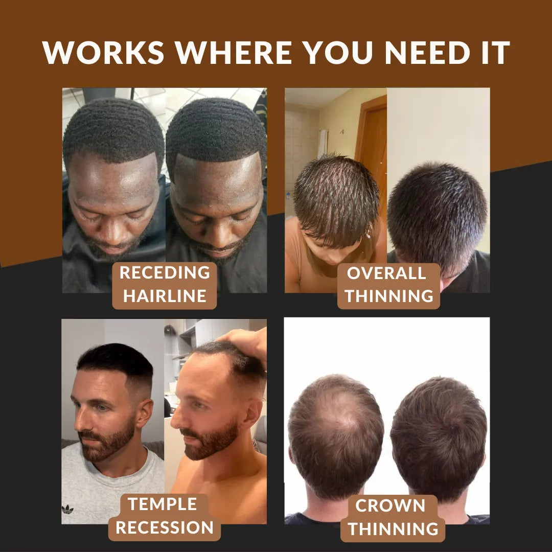 50% RABATT | Kerablend™ Mineral-Haarverdichtung | Sofort volleres Haar in 60 Sekunden ☀️ Ideal für den Sommer