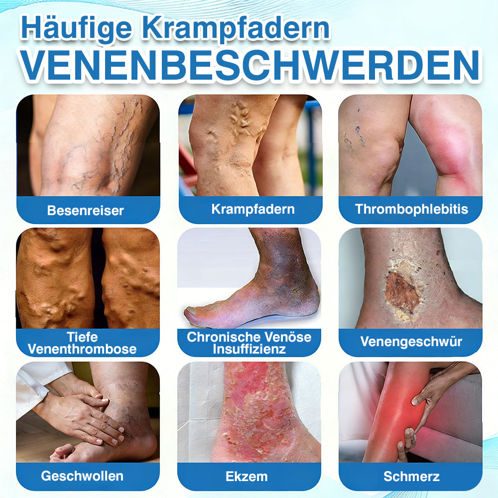 🇩🇪🏃‍🌿GFOUK® VascuCare Vein Healing Spray(Entwickelt für Krampfadern, Besenreiser, tiefe Venenthrombose (TVT), chronische venöse Insuffizienz, venöse Geschwüre, Thrombophlebitis und andere venöse Beschwerden)
