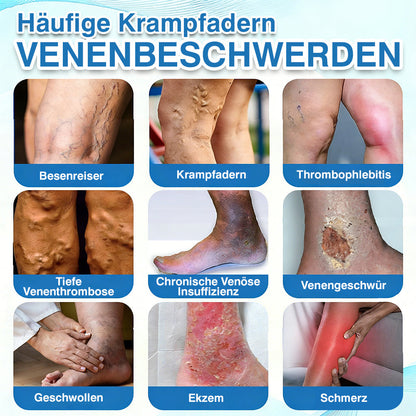 🇩🇪🏃‍🌿GFOUK® VascuCare Vein Healing Spray(Entwickelt für Krampfadern, Besenreiser, tiefe Venenthrombose (TVT), chronische venöse Insuffizienz, venöse Geschwüre, Thrombophlebitis und andere venöse Beschwerden)