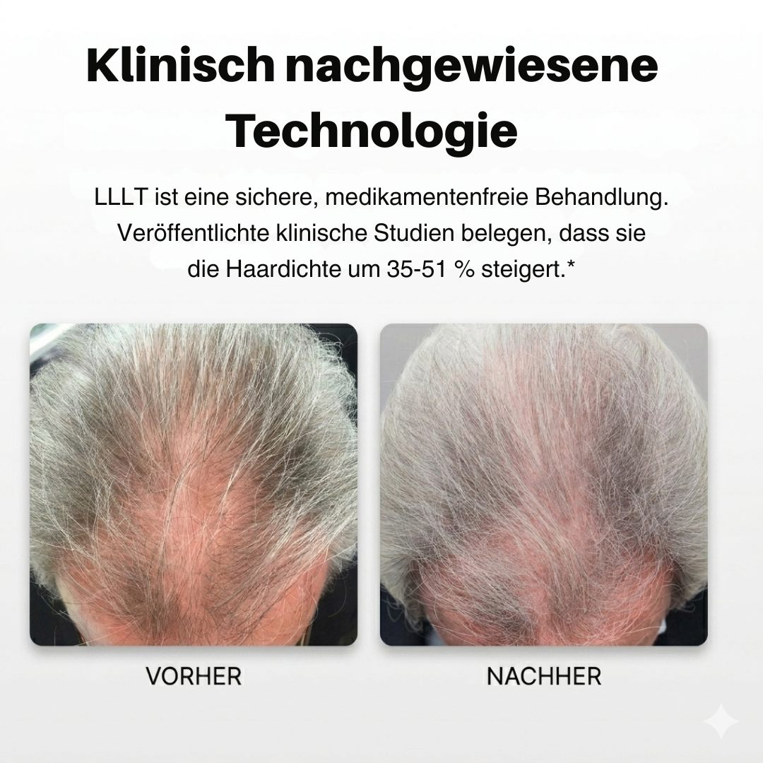Xtrallux TurboPro (316) Professionelle Laserhaube für dichteres Haar