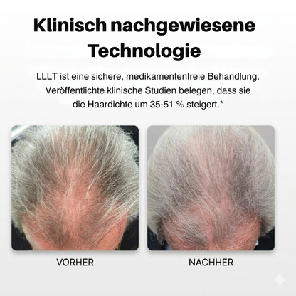 Xtrallux TurboPro (316) Professionelle Laserhaube für dichteres Haar
