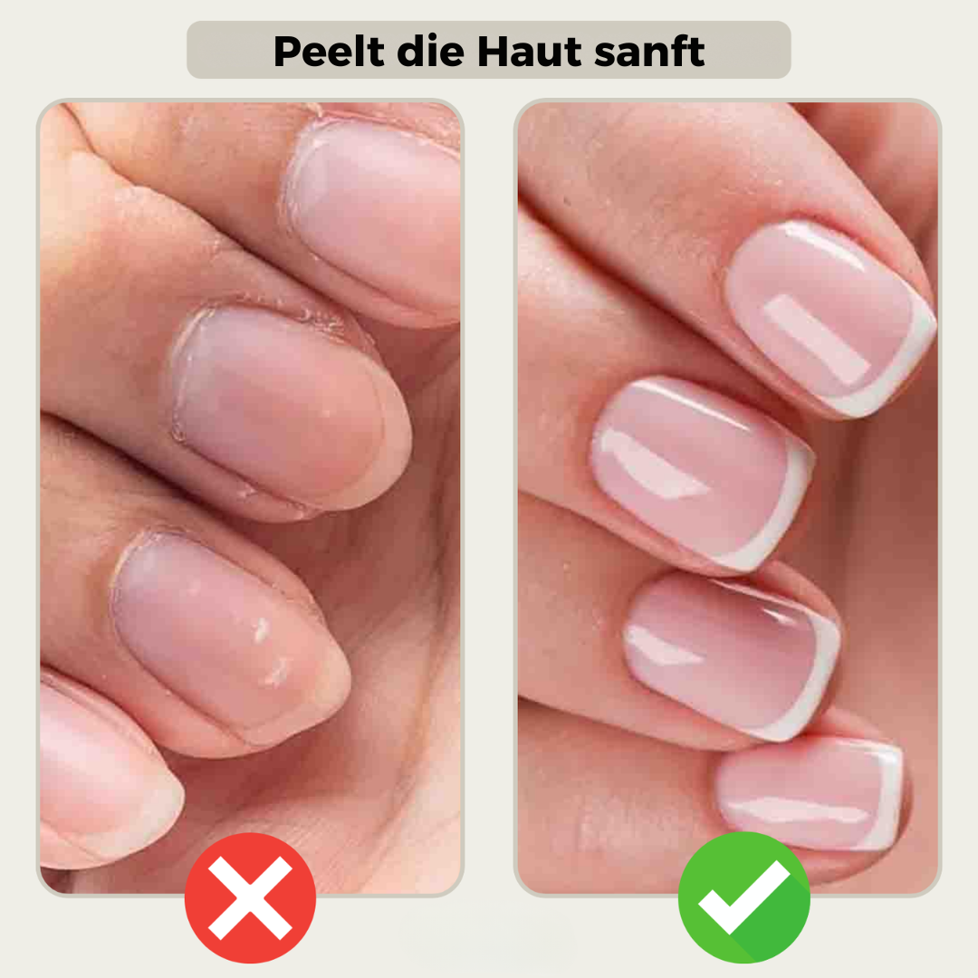 1+1 GRATIS | GlossBloom™  – Gesunde, schöne Nägel in Sekundenschnelle!