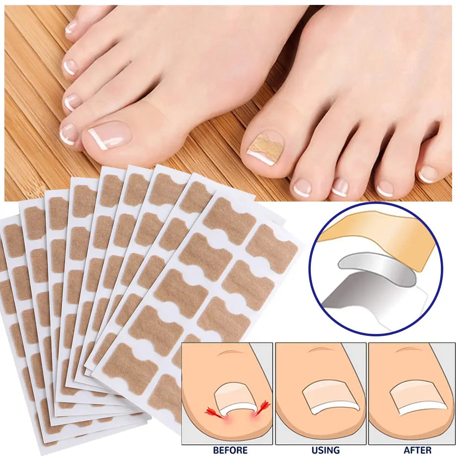 HealthyNail – Nagelpflegepflaster für ein natürliches Nagelbild