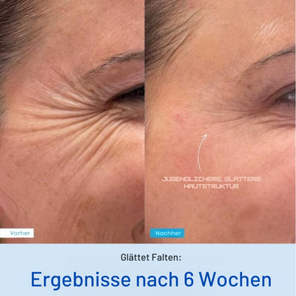Vellista SkinLift™ | Mikrostrom & LED-Therapie für Gesicht & Hals | bekämpft Hautunreinheiten und lässt die Haut strahlen